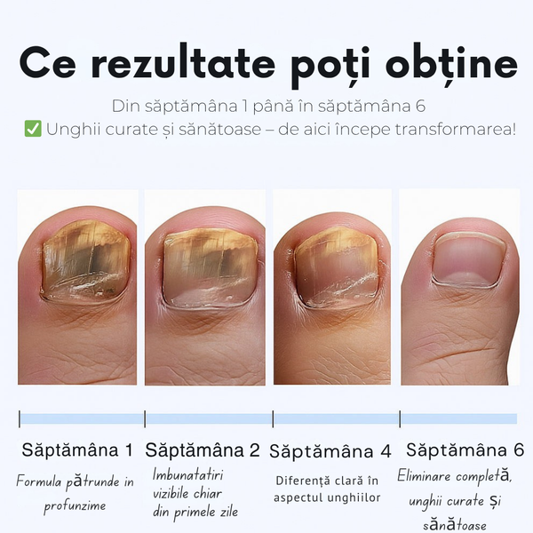 Patch-uri Magice pentru Unghii Sănătoase