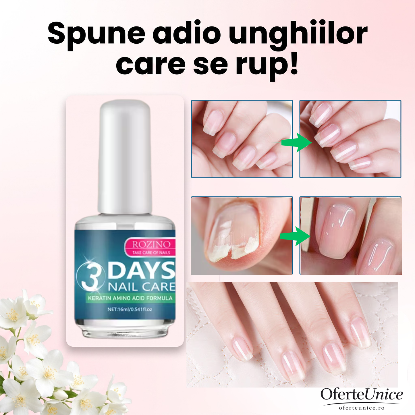 Nutrikera™ – Lac cu Keratină pentru Unghii Puternice