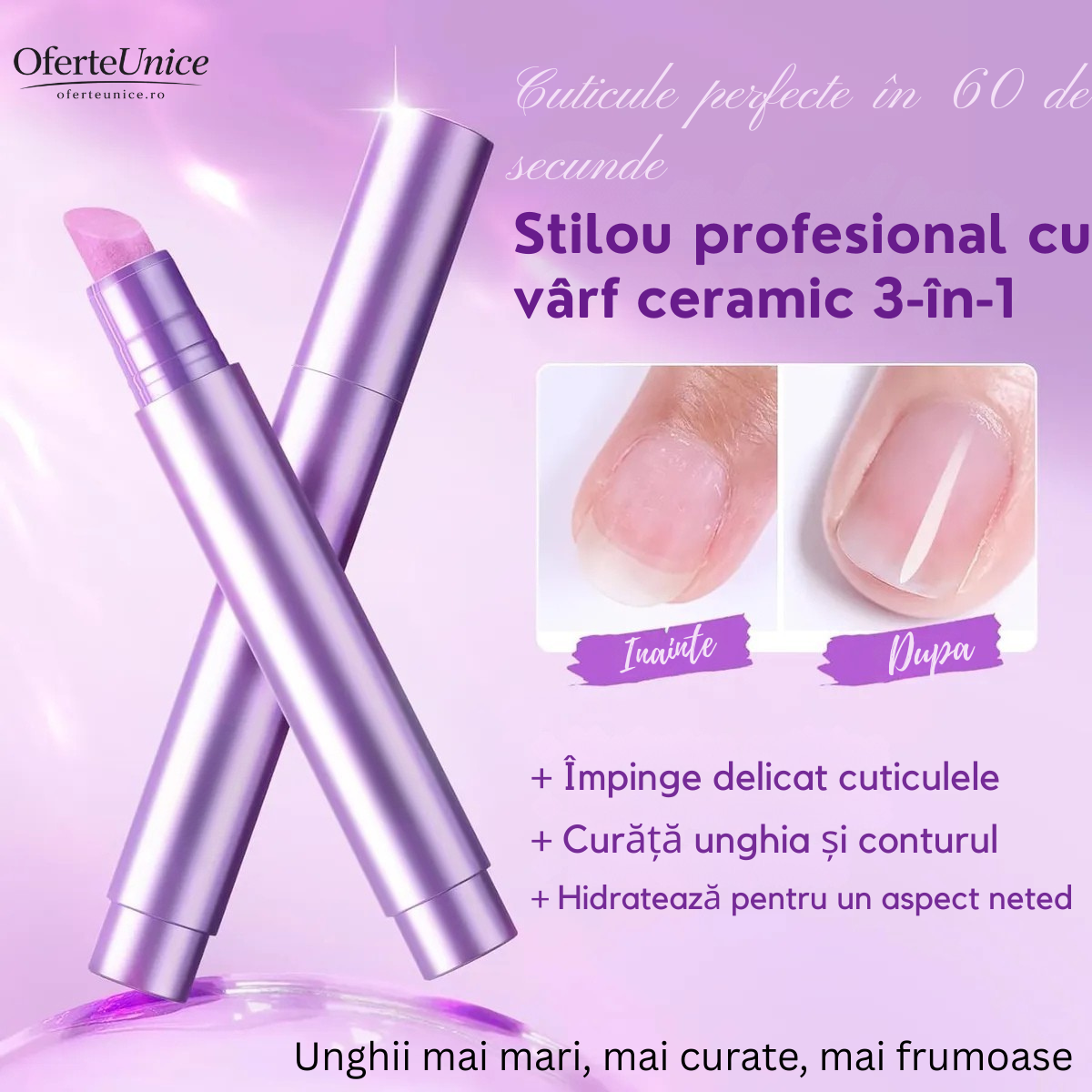 VeluNails™ – Stiloul 3-în-1 pentru cuticule catifelate