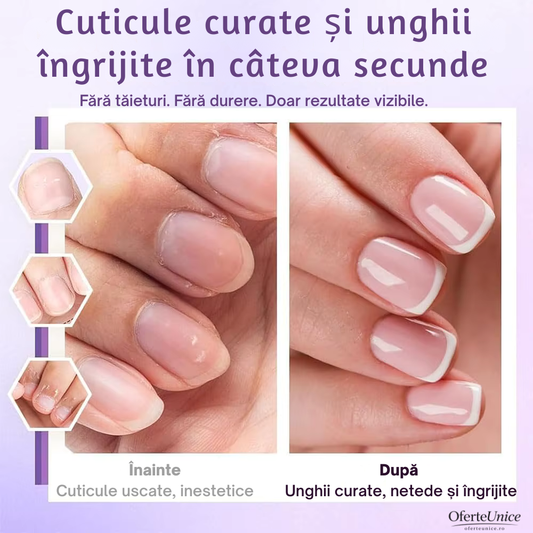 VeluNails™ – Stiloul 3-în-1 pentru cuticule catifelate